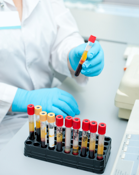 doctor in white coat holds blood sample