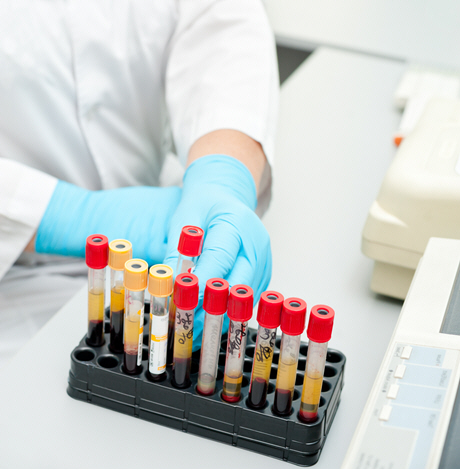 doctor in white lab coat with rack of blood samples