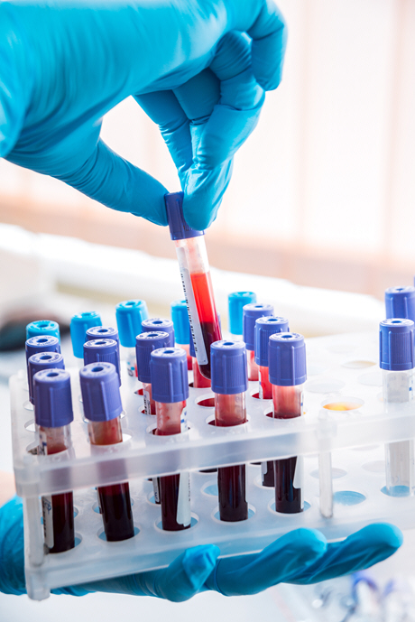 doctor pulls blood sample from rack 2