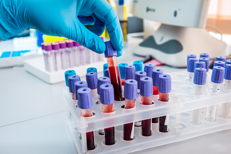 doctor pulls blood sample from rack 3