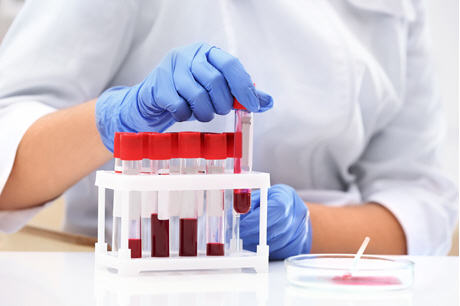 doctor pulls blood sample from rack