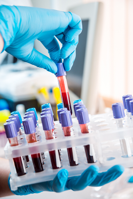 doctor pulls tube of blood from rack