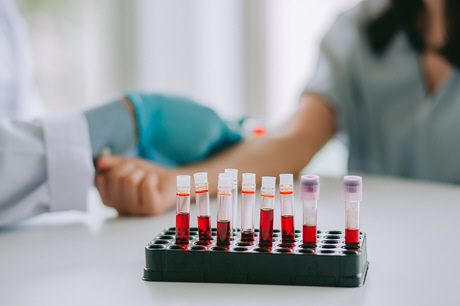 doctor taking blood sample from patient