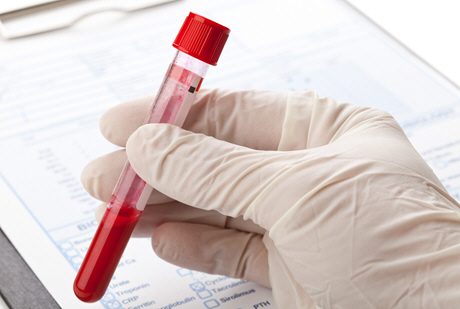 doctor taking notes on blood sample