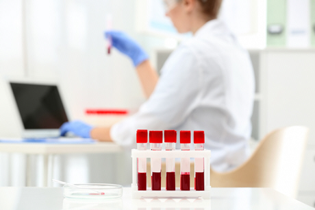 doctor using computer to analyze blood