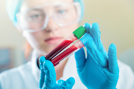 female doctor examines two blood samples