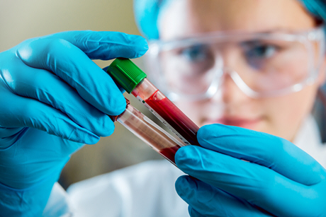 female doctor examines two blood viles